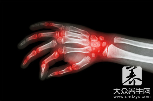 痛风可以吃什么肉类