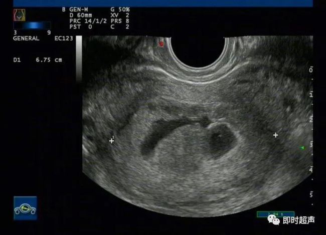 ����ʳ��_��������С����ʳ��_��Ȼ������ʳ��