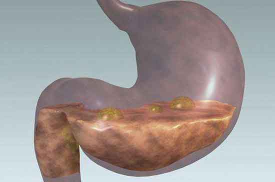 ��֭������θ�׵�ʳ��_��֭����θ����θʳ��_����֭��θ��