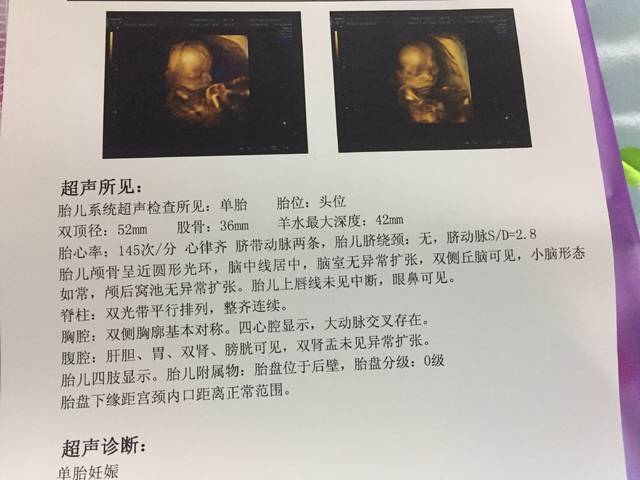 妊娠期糖尿病食谱主编是谁_适合糖尿病人的食谱_养生保健知识大全糖尿病患者补铁食谱