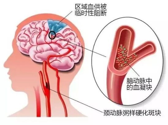 �Թ�����ʳ�ײ��˲���_������Ѫ˨���κ���_��Ѫ˨����һ��ʳ��