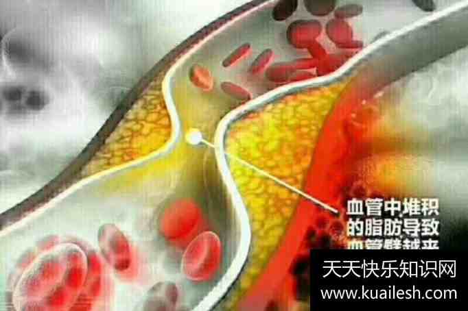 �Թ�����ʳ�ײ��˲���_������Ѫ˨���κ���_��Ѫ˨����һ��ʳ��