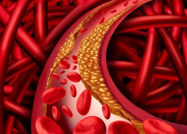 ������Ѫ˨���κ���_�Թ�����ʳ�ײ��˲���_��Ѫ˨����һ��ʳ��