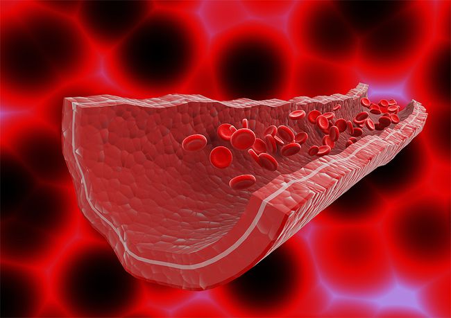 �Թ�����ʳ�ײ��˲���_��Ѫ˨����һ��ʳ��_������Ѫ˨���κ���