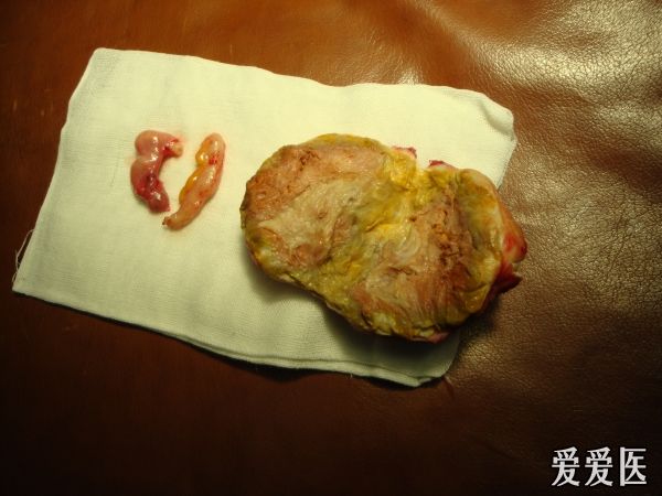 ���긹ǻ��������ʳ��_��������������ʳ��_���ھ��±����������Ǯ