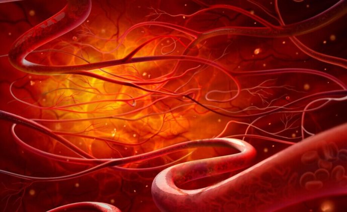 Ԥ�����˻�֢_�Զ���������Ѫ��_����Ѫ�ܲ�Ԥ��ʳ��