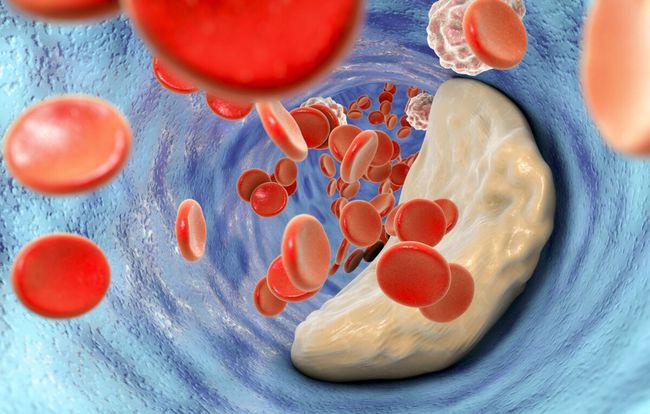 ��ΧѪ�ܼ��������������Ԥ��_����Ѫ�ܲ�Ԥ��ʳ��_����������Ѫ����