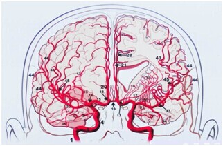 ����������Ѫ����_��ΧѪ�ܼ��������������Ԥ��_����Ѫ�ܲ�Ԥ��ʳ��