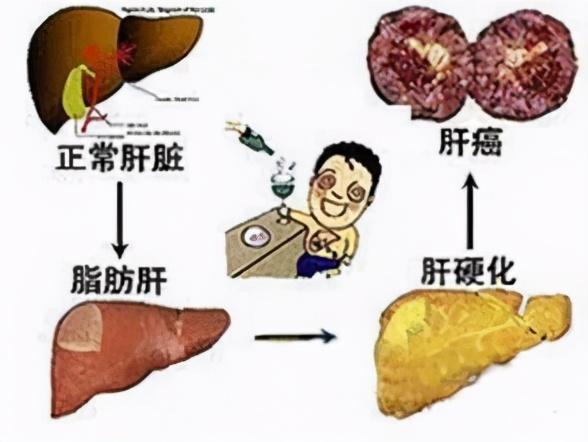 �ΰ����ڻ���_�ΰ����ڻ��ߵ�ʳ��_�ΰ����ڻ����ܻ���