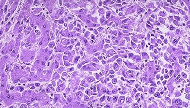 �ΰ�����ʳ��_�ΰ����˴�Ⱦ��_�ΰ����˲�Ʒ