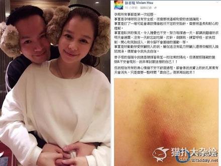 徐若瑄怀孕食谱_徐若瑄怀孕为什么卧床_徐若瑄怀孕照片