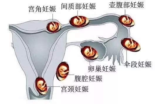 ǰʳ_ǰʳ׵_ǰʳ׵