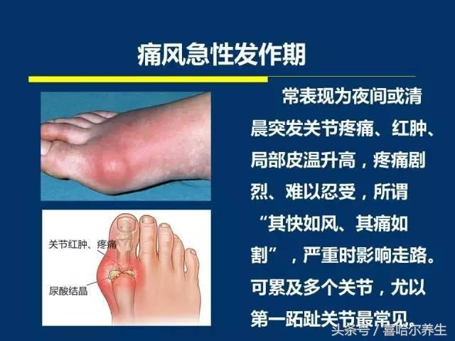 ʹ��һ��ʳ��_ʹ����Ⱥ��ʳ��_ʹ��ʯʳ��