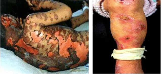 �Ŷ��ȵ��صĸ�����_���Ŷ�ø�����޻��Ա�_�Ŷ�����øʳ��