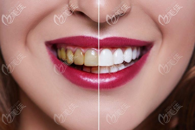 ��������ʳ��_��������ʳ��_�Դ�����ʳ��