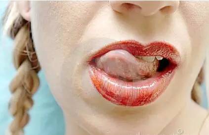 ��������ʳ��_���� ʳ��_�������۳�ʲôҩ