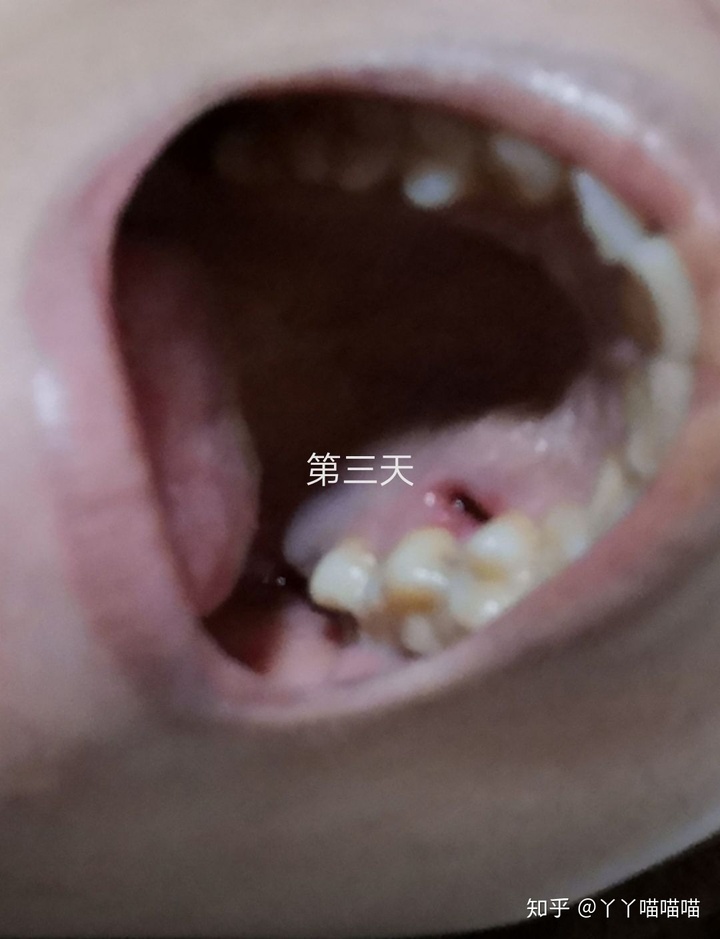 ��������ʳ��_�������۳�ʲôҩ_���� ʳ��