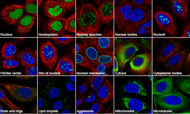 ���Ŷ�ø����Ǯһ֧_���Ŷ�ø�����޻��Ա�_�Ŷ�����øʳ��